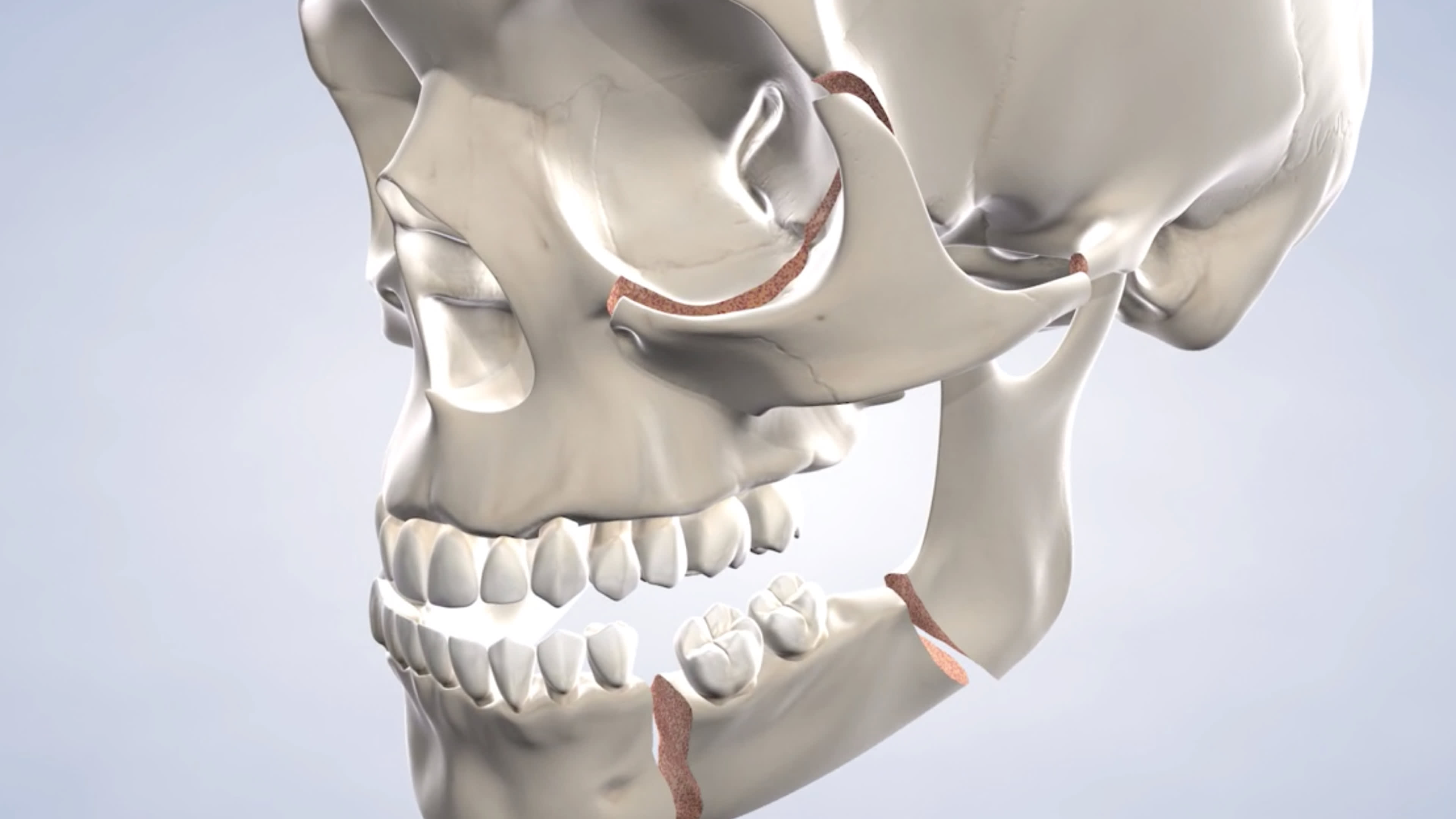 instruction facial trauma
