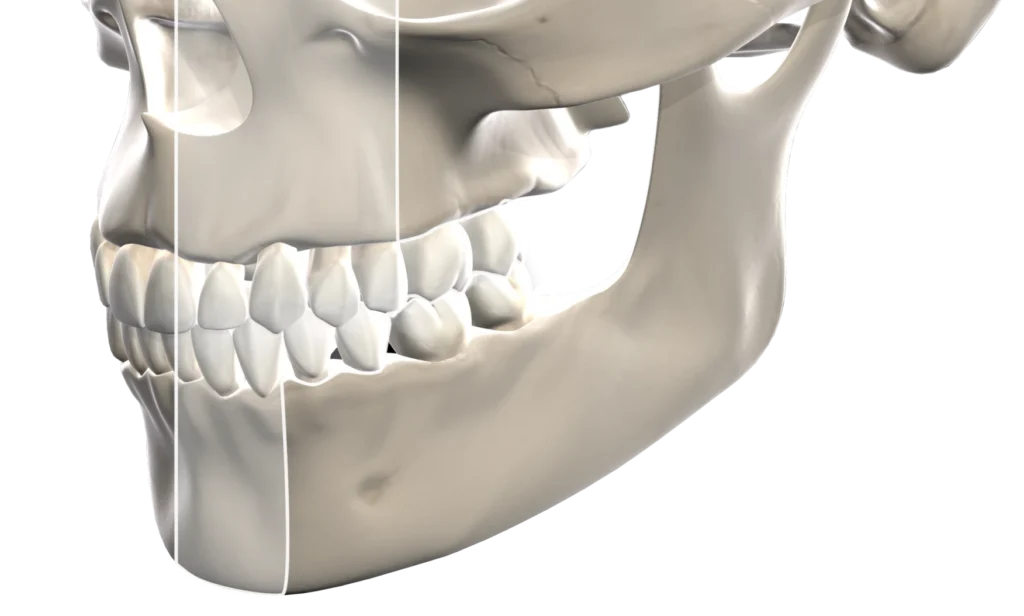 3d Teeth Scanning