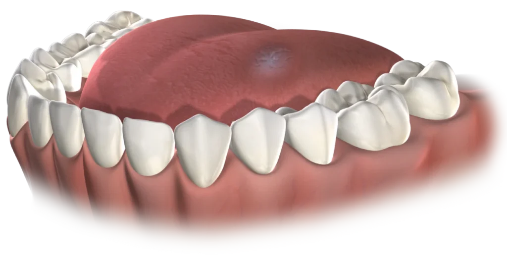 Oral Pathology