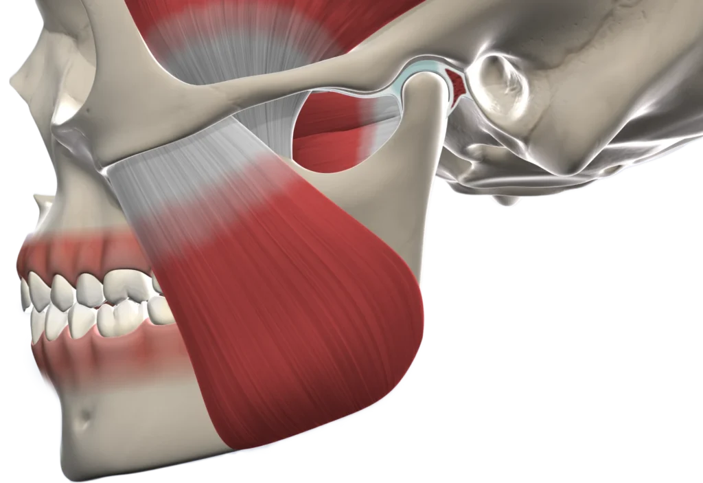 TMJ Surgery