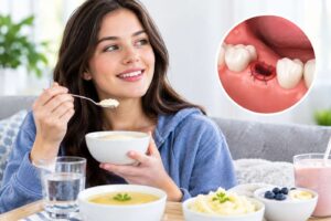 How Long After Wisdom Teeth Removal Can I Ea